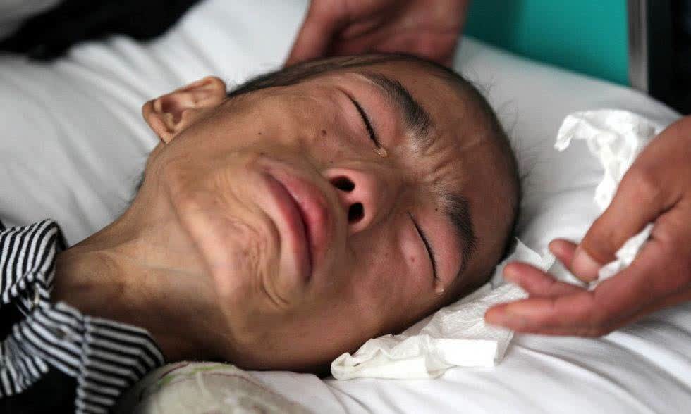 晚期癌症患者到底有多遭罪?光是癌痛就难说!